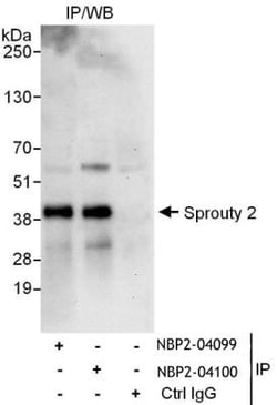 SPRY2 Antibody, Novus Biologicals 0.1mg; Unlabeled:Antibodies, Polyclonal
