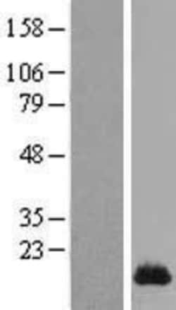 Novus Biologicals&trade;&nbsp;SPRR1A Overexpression Lysate
