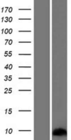 Novus Biologicals&trade;&nbsp;SPRR2G Overexpression Lysate