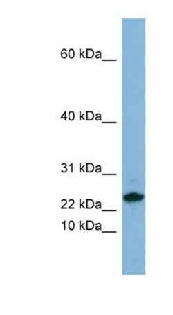 SPRR3 Antibody, Novus Biologicals 100&mu;L; Unlabeled:Antibodies, Polyclonal