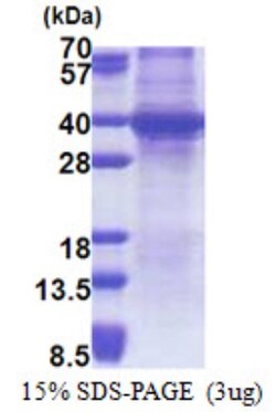 Novus Biologicals&trade;&nbsp;Recombinant Human SPRY4 His Protein