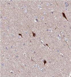 SPRYD3 Antibody, Novus Biologicals 25 &mu;L | Buy Online | Novus Biologicals | Fisher Scientific