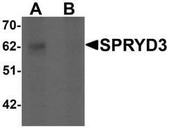 SPRYD3 Antibody - BSA Free, Novus Biologicals 0.1mg; Unlabeled:Antibodies,