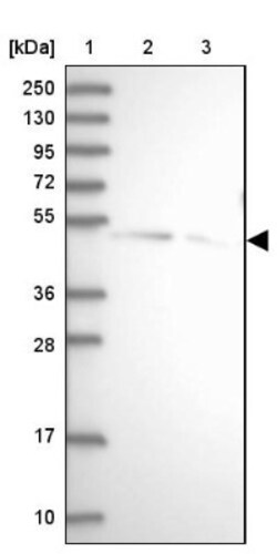 SPRYD3 Antibody, Novus Biologicals 25 &mu;L | Buy Online | Novus Biologicals | Fisher Scientific