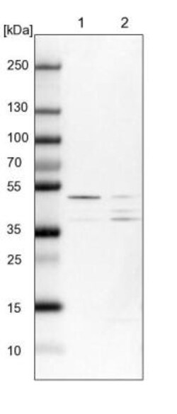 SPRYD3 Antibody, Novus Biologicals 25 &mu;L | Buy Online | Novus Biologicals | Fisher Scientific