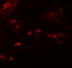 SPRYD4 Antibody - BSA Free, Novus Biologicals 0.025 mg | Buy Online | Novus Biologicals | Fisher Scientific