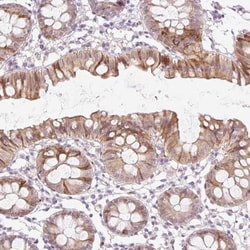 SPRYD4 Antibody, Novus Biologicals 0.1mL; Unlabeled:Antibodies, Polyclonal