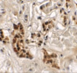 SPRYD4 Antibody - BSA Free, Novus Biologicals 0.025 mg | Buy Online | Novus Biologicals | Fisher Scientific