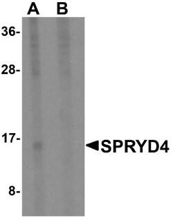 SPRYD4 Antibody - BSA Free, Novus Biologicals 0.025 mg | Buy Online | Novus Biologicals | Fisher Scientific