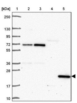 SPRYD4 Antibody, Novus Biologicals 0.1mL; Unlabeled:Antibodies, Polyclonal
