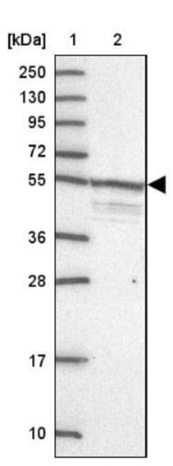 SPRYD5 Antibody, Novus Biologicals 25 &mu;L, Unlabeled:Antibodies, Polyclonal
