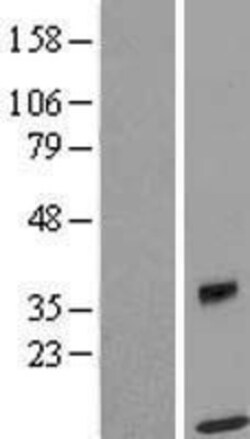 Novus Biologicals&trade;&nbsp;SPRYD5 Overexpression Lysate