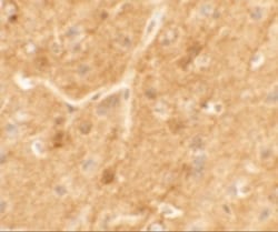 SPRYD5 Antibody - BSA Free, Novus Biologicals 0.1mg; Unlabeled:Antibodies,