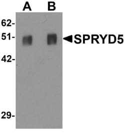 SPRYD5 Antibody - BSA Free, Novus Biologicals 0.1mg; Unlabeled:Antibodies,