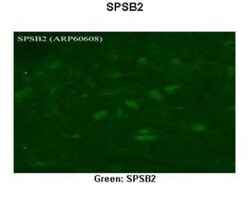 SPSB2 Antibody, Novus Biologicals 100&mu;L; Unlabeled:Antibodies, Polyclonal