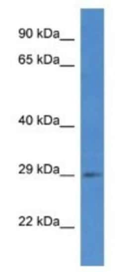 SPSB2 Antibody, Novus Biologicals 100&mu;L; Unlabeled:Antibodies, Polyclonal
