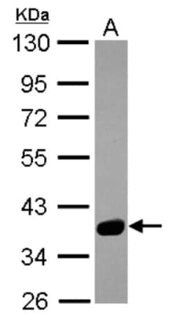 SPSB3 Antibody, Novus Biologicals 0.1mL; Unlabeled:Antibodies, Polyclonal