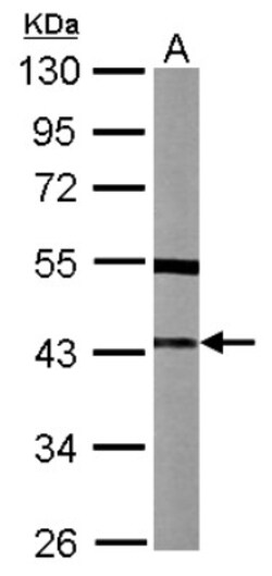 SPSB3 Antibody, Novus Biologicals 0.1mL; Unlabeled:Antibodies, Polyclonal