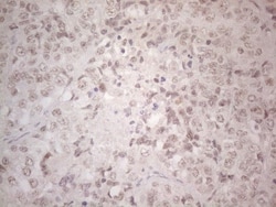 SPT3 Antibody (OTI1A5), Novus Biologicals 0.1 mL | Buy Online | Novus Biologicals | Fisher Scientific