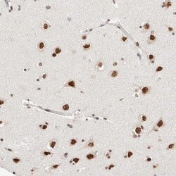 SPT3 Antibody, Novus Biologicals 0.1mL; Unlabeled:Antibodies, Polyclonal