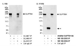 Spt6 Antibody, Novus Biologicals 100 &mu;L | Buy Online | Novus Biologicals | Fisher Scientific