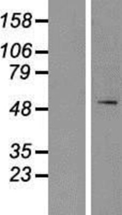 Novus Biologicals&trade;&nbsp;SPTLC1 Overexpression Lysate