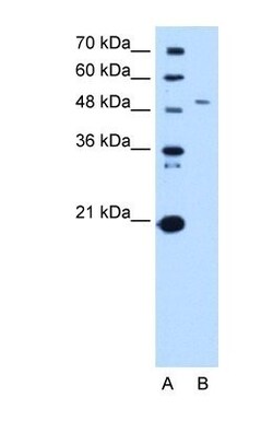 SPTLC1 Antibody, Novus Biologicals:Antibodies:Primary Antibodies