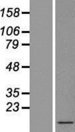 Novus Biologicals&trade;&nbsp;SPTSSB Overexpression Lysate