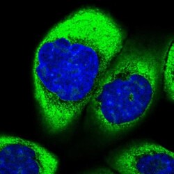 SPTY2D1 Antibody, Novus Biologicals 25 &mu;L, Unlabeled:Antibodies, Polyclonal