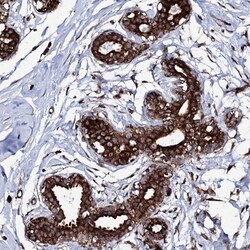 SPTY2D1 Antibody, Novus Biologicals 25 &mu;L, Unlabeled:Antibodies, Polyclonal