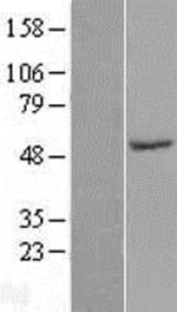 Novus Biologicals&trade;&nbsp;SPZ1 Overexpression Lysate