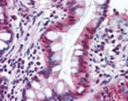 SRI Antibody - BSA Free, Novus Biologicals 0.025mg; Unlabeled:Antibodies,