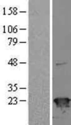 Novus Biologicals™ SRI Overexpression Lysate