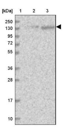 SR140 Antibody, Novus Biologicals 0.1mL; Unlabeled:Antibodies, Polyclonal