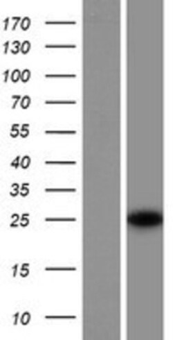 Novus Biologicals&trade;&nbsp;SRA1 Overexpression Lysate