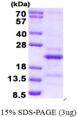 Novus Biologicals&trade;&nbsp;Recombinant Human SRA1 His Protein