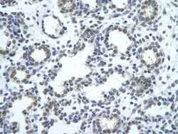 SRBD1 Antibody, Novus Biologicals 100&mu;L; Unlabeled:Antibodies, Polyclonal