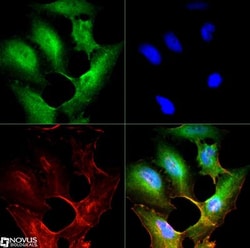 SR-BI Antibody, Novus Biologicals 0.025mL; Unlabeled:Antibodies, Polyclonal