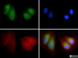 LIMPII/SR-B2 Antibody, Novus Biologicals 0.1mL; Unlabeled:Antibodies, Polyclonal