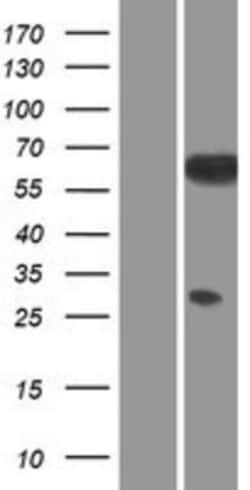Novus Biologicals&trade;&nbsp;Src Overexpression Lysate