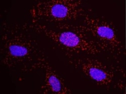 SRC1 Antibody, Novus Biologicals 100 &mu;L | Buy Online | Novus Biologicals | Fisher Scientific