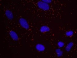 SRC1 Antibody, Novus Biologicals 100 &mu;L | Buy Online | Novus Biologicals | Fisher Scientific