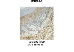 SRD5A2 Antibody, Novus Biologicals 0.05mg; Unlabeled:Antibodies, Polyclonal