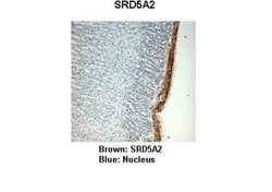 SRD5A2 Antibody, Novus Biologicals 0.05mg; Unlabeled:Antibodies, Polyclonal