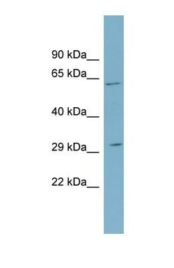 SRD5A2 Antibody, Novus Biologicals 0.05mg; Unlabeled:Antibodies, Polyclonal