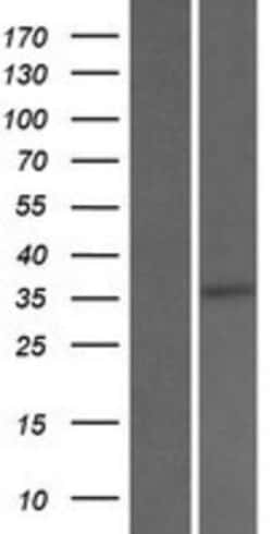 Novus Biologicals™ SRD5A3 Overexpression Lysate
