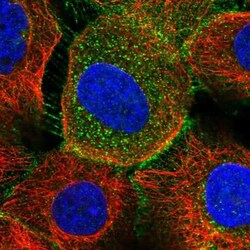 SRD5A3 Antibody, Novus Biologicals 25 &mu;L | Buy Online | Novus Biologicals | Fisher Scientific