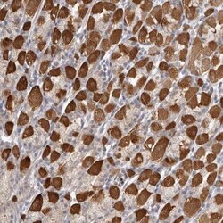 SRD5A3 Antibody, Novus Biologicals 25 &mu;L | Buy Online | Novus Biologicals | Fisher Scientific