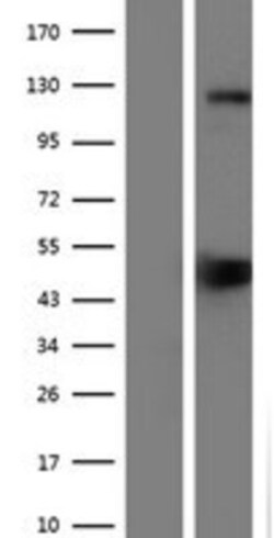 Novus Biologicals&trade;&nbsp;SREBP1 Overexpression Lysate