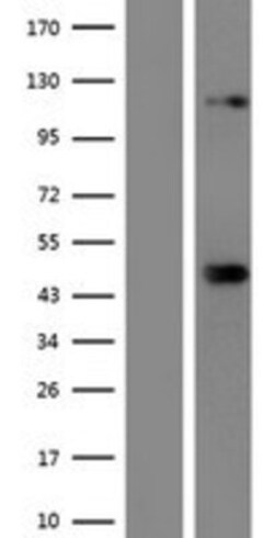 Novus Biologicals™ SREBP2 Overexpression Lysate